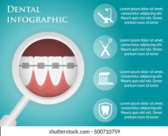 Template design dental infographics with icons, for your website, brochures. Braces for teeth alignment.