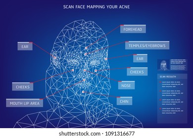 The Template Scan Face Mapping Your Acne