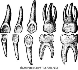 Temporary teeth, also called primary teeth or baby teeth, they are the first set of teeth in the growth development of humans, vintage line drawing or engraving illustration.