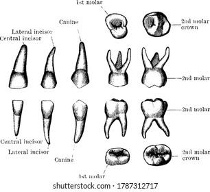 Vector Illustration Types Meniscus Tear Stock Vector (Royalty Free ...