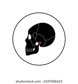 Temporomandibular joint disorder. TMD or TMJ dysfunction. Pain in the jaw joint, temporal bone locking or displaced disc. Transcutaneous electrical nerve stimulation. Human skull and mandible vector