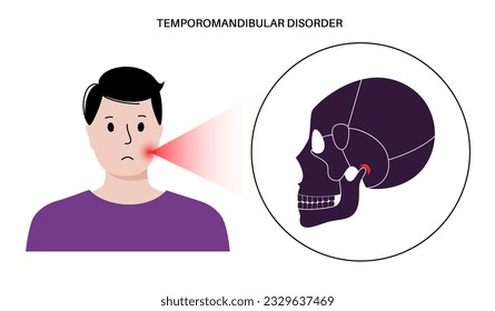 Temporomandibular joint disorder. TMD or TMJ dysfunction. Pain in the jaw joint, temporal bone locking or displaced disc. Transcutaneous electrical nerve stimulation. Human skull and mandible vector