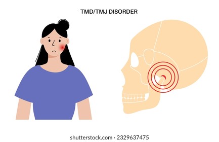 Temporomandibular joint disorder. TMD or TMJ dysfunction. Pain in the jaw joint, temporal bone locking or displaced disc. Transcutaneous electrical nerve stimulation. Human skull and mandible vector