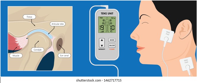 Temporomandibular Joint Disorders TMD TMJ treat pain displaced disc temporal bone locking bite plate plastic guard night Transcutaneous electrical nerve stimulation TENS Arthroscopy occlusal