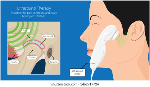 Temporomandibuläre Gelenkerkrankungen TMD TMJ behandelt Schmerzen verdrängte Scheiben-Scheiben-Verschluss Plättchen Kunststoff-Nacht Transkutane elektrische Nervenstimulation TENS Arthroscopy ocklusal