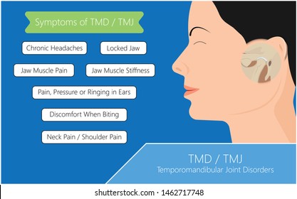 Temporomandibuläre Gelenkerkrankungen TMD TMJ behandelt Schmerzen verdrängte Scheiben-Scheiben-Verschluss Plättchen Kunststoff-Nacht Transkutane elektrische Nervenstimulation TENS Arthroscopy ocklusal