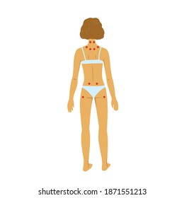 Tenders points of fibromyalgia. Vector illustration of woman body on white background.