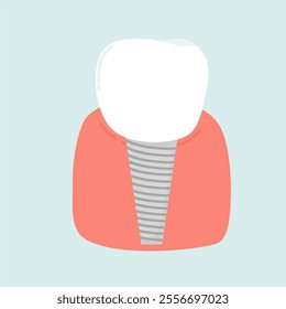 Tental Implants in Cases of Tooth Loss