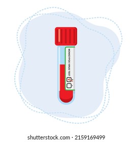 Test tube with blood for the determination of the monkeypox virus. Blood sample for research in the laboratory.