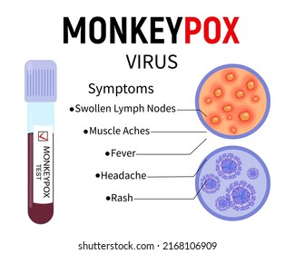 Tubo de ensayo con sangre para la prueba del virus de la monovena, muestra de piel humana con erupción y células del virus sobre fondo blanco. Síntomas de la varicela. Ilustración vectorial.