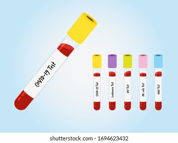 Test Tube With Blood Sample For COVID-19 (coronavirus 2019), Leukemia, HIV, NK Cells And AMH Test On Blue Background