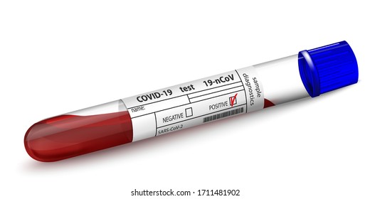 Tubo de prueba con muestra de sangre para el diagnóstico del virus Covid 19. Resultado positivo Formulario para el resultado del ensayo Coronavirus 2019-nCoV. Vidrio realista 3d Aislado en blanco. Ilustración del vector