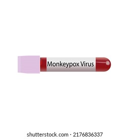 Test tube with monkeypox virus