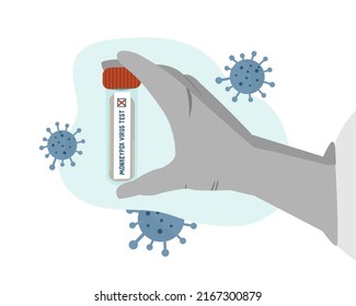 test tube with positive test monkeypox virus. Concept. gloved hand holds an infected blood sample. Virus particles. Vector illustration, flat
