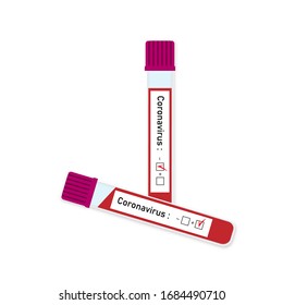 Tubos de prueba para análisis de sangre KOVID-19, prueba del coronavirus. Dos tubos de ensayo con resultados positivos y negativos para el coronavirus Covid-19. Ejemplo aislado de la epidemia de coronavirus 2019