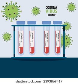 test tubes with blood, checking for virus