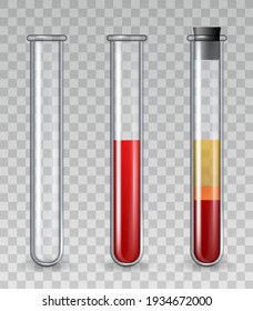 Test tubes with blood. Realistic glass medical tube empty, filled with red cells, platelet rich plasma. PRP dermatology therapy vector set
