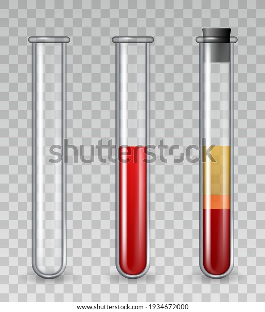 Test tubes with blood. Realistic glass medical tube\
empty, filled with red cells, platelet rich plasma. PRP dermatology\
therapy vector set