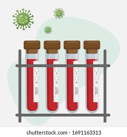 Teströhrchen mit Blut. Tests zur Bestimmung von Viren im Blut. Flache Vektorgrafik.