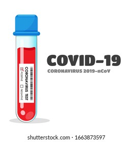 Tubos de prueba que recogen muestras de sangre de pacientes con el virus de la corona.