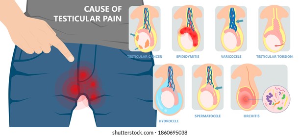 Testicular Disorder Men Vas Pus Tube Male Pain Cyst Test Exam Self Cord Vein Sperm Acute Blood Semen Tract Penis Viral Virus Tumor Fluid Testes Pelvic Sexual Penile Trauma System Prostate Testis
