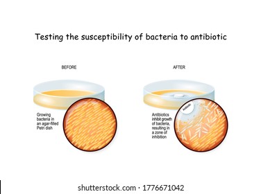 Testing the susceptibility of bacteria to antibiotics. bacteria growing in an agar-filled Petri dish. Experiment. The disk-diffusion agar method tests the effectiveness of antibiotics