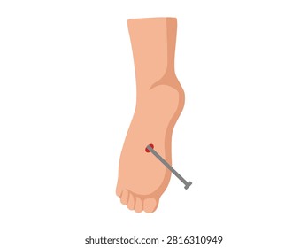 Tetanus Bacteria by a Tetanus Nail