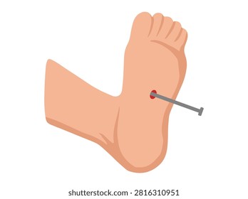Tetanus Bacteria by a Tetanus Nail