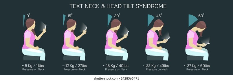 Text Neck Syndrome of phone posture is the onset of cervical spinal degeneration from excess look down at mobile screens. Aka Anterior head prevention. Cervical neck aches vector illustration. 