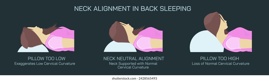 Text Neck Syndrome of phone posture is the onset of cervical spinal degeneration from excess look down at mobile screens. Aka Anterior head prevention. Cervical neck aches vector illustration. 