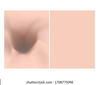 Texture with acne scars and acne. Before After scar cysts. Skin background.  Vector illustration