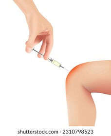 Therapeutic Blockage Realistic Vector Anatomical Scheme with Medicines Injection in Sick and Inflamed Knee Joint, Effect of Medical Therapy Illustration. Treatment of Joints Painful Diseases Chart.