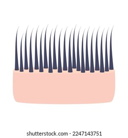 Dicke dicker Haare. Hautquerschnitt mit dünnen Strängen. Lineares anatomisches Strukturschema. Medical and Beauty Concept. Vektorgrafik.