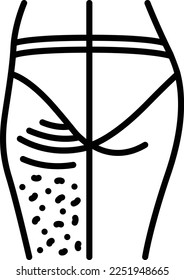 Thigh lift or thighplasty concept, Exfoliation vector line icon design, beauty and personal care symbol, cosmetic dermatology sign, body aesthetics stock illustration