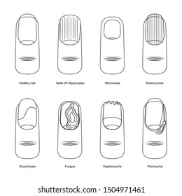 Thin Line Design Nail Diseases Icon Set Element Problem Toenail Concept . Vector illustration of Nails