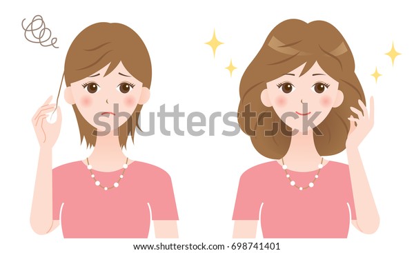 Thinning Hair Treatment Before After Stock Image Download Now