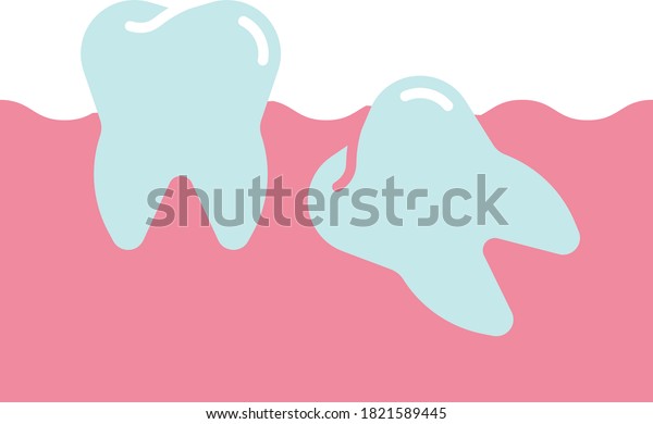 Third Molar Design Wisdom Teeth Vector Stock Vector Royalty Free Shutterstock