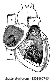 This diagram represents Cavities of the right side of the heart, vintage line drawing or engraving illustration.