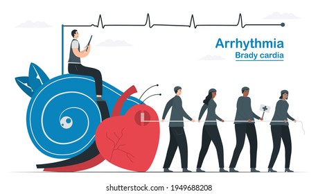 This heart disease problem is bradycardia arrhythmia. Diagnostic and analysis shows that periodic signal is slow impulse response around sinus node. Cardiology vector illustration. 