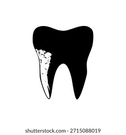 Este gráfico en blanco y negro de alto contraste representa un solo diente estilizado. La silueta negra presenta un parche blanco prominente e irregular en el lado izquierdo de su corona y raíz. Esta área de daño estilizado sugiere caries dental, una cavidad o erosión del esmalte en la superficie del diente.