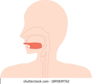 Das ist eine Illustration von Ankyloglossia.