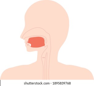 Esta es una ilustración de Anquiloglosia.