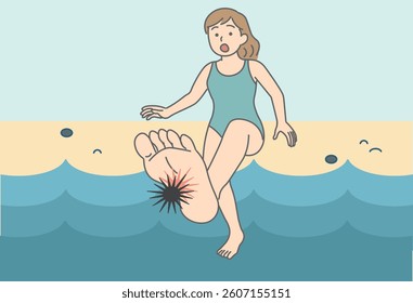 This illustration depicts a woman who injured her foot by stepping on a sea urchin.
