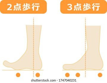 This is an illustration of a floating finger (two-point gait and three-point gait).