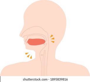 This is an illustration of a low tongue.