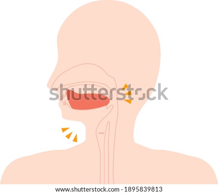 This is an illustration of a low tongue.