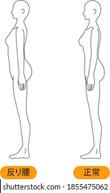 This is an illustration of poor posture.
(Japanese is  Thoracic spine/　normal)