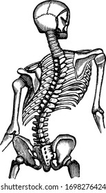 Diese Illustration repräsentiert Deformiertes Thorax, Vintage-Linienzeichnung oder Gravur-Illustration.