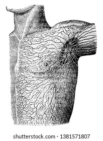 Diese Illustration stellt Lymphatik des Schulters, Vintage-Linien-Zeichnung oder Gravur-Illustration dar.