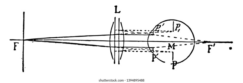 This illustration represents Optical Position and Size of Image Through Lens in Front of Eye vintage line drawing or engraving illustration.